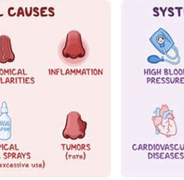 common causes