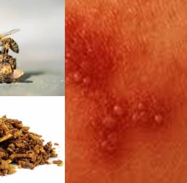 effectiveness as strong antiherpetic agents.