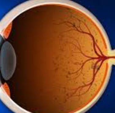 Retinitis Pigmentosa Fasting, Autophagy, Stem Cells, and Emerging Therapies