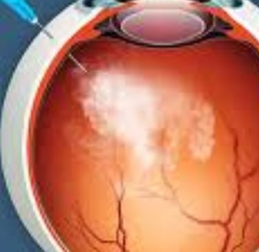 Retinitis Pigmentosa Fasting, Autophagy, Stem Cells, and Emerging Therapies