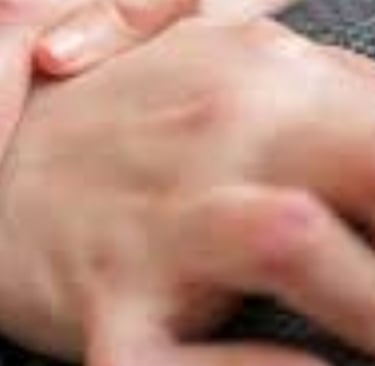التهاب المفاصل الروماتويدي : نهج متعدد في العلاج - الصيام