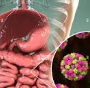 S Norwalk virus (norovirus), enteric adenoviruses, astrovirus, cytomegalovirus, and hepatitis viruse