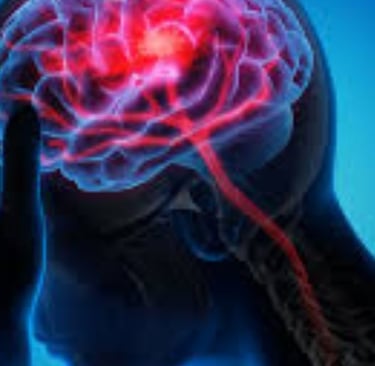 Stroke : Symptoms, Causes, Treatments, Guidelines and My Point of View