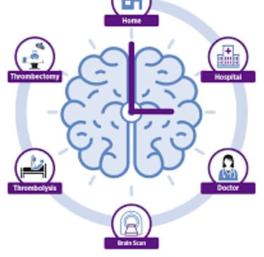 time is brain