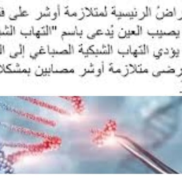 متلازمة آ,شر