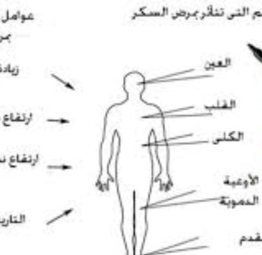 كيف يحدث السكرى