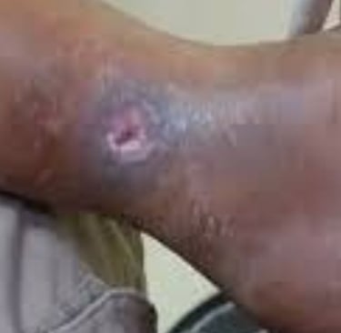 طفح جلدي أو ندوب حمراء