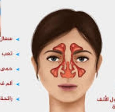 الحمى، القشعريرة، التعب، آلام العضلات، فقدان الشهية، الغثيان والقيء، الإسهال، السعا مشاكل نكش الانف