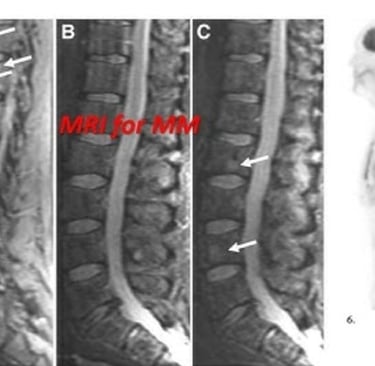 a series of images of a bone fracture