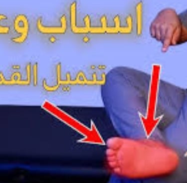 اسباب وعلاج تنميل القدمين