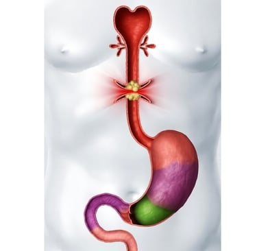 vomiting and obstructions in the upper gastrointestinal tract 