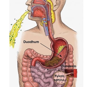 vomiting and obstructions in the upper gastrointestinal tract 