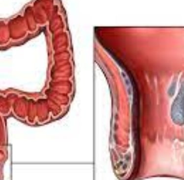 the small intestine beyond the duodenum, the colon, rectum, and anal canal.