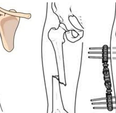 bone break down