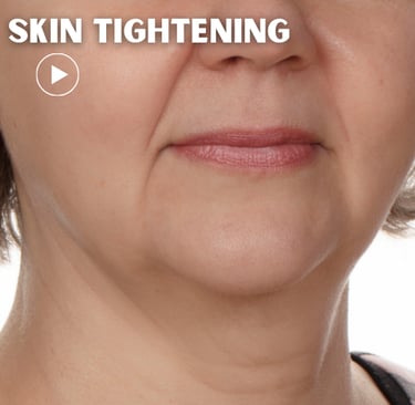 a woman with losse skin