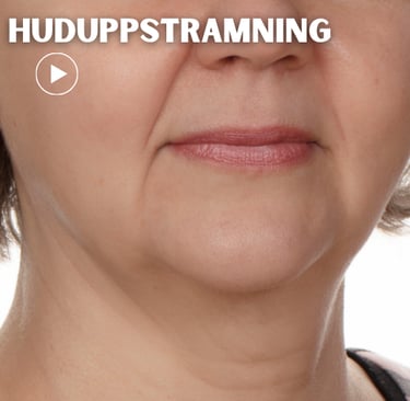 woman with losse skin