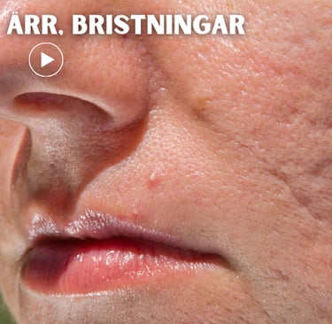 a person with scars in the face