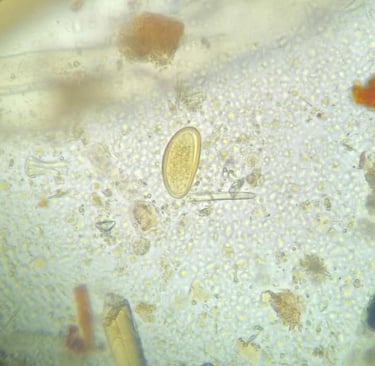 Ovo de Enterobius vermicularis