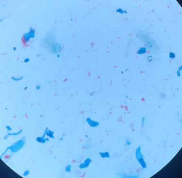 Imagem do Artigo sobre Hanseníase