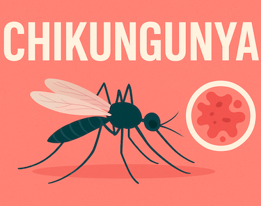 Chikungunya symptoms and treatment