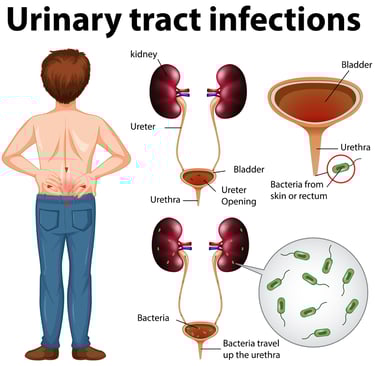 UTI