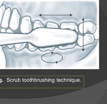 Scrub technique of brushing