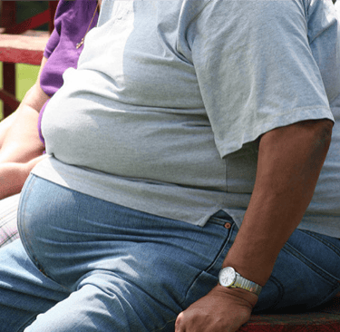 Obesity man