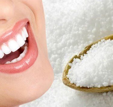 tẩy trắng răng tại nhà