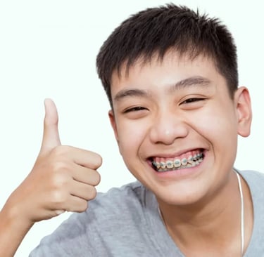 độ tuổi niềng răng cho trẻ em