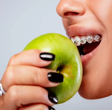 Chăm sóc răng sau khi niềng