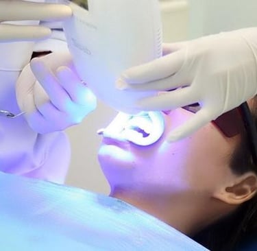 tẩy trắng răng an toàn không?