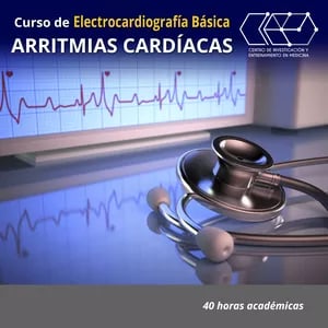 Aprendeblog Arritmias Cardíacas