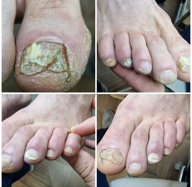 nagu grybelis pradžia 2023 gegužės 5 diena