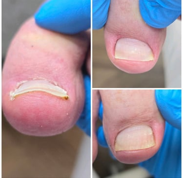 iauges nagas gydymo pabaiga 2024-02-24