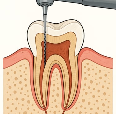 Root Canal Treatment Hayathnagar Hyderabad Best Dentist