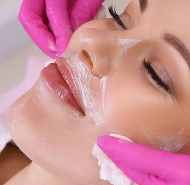 tratamiento facial orihuela costa