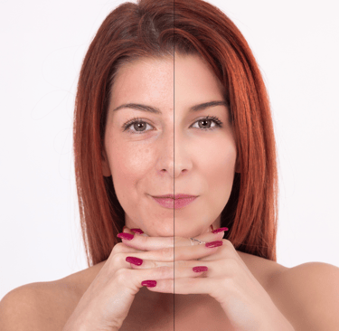 Anti-Aging Treatments