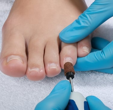 Professional podiatrist using an electric nail drill to perform a medical pedicure on a patient's toenails.