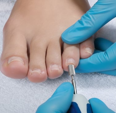 Professional podiatrist using an electric nail file for medical pedicure on a patient's toenails.