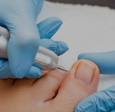 Professionelle Fußpflege, Fusspflege Overath..Fußüberholung mit Motor und Schleifmaschine