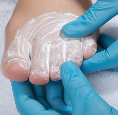 A healthcare professional in blue gloves applying antifungal cream to a patient's toes for foot treatment.