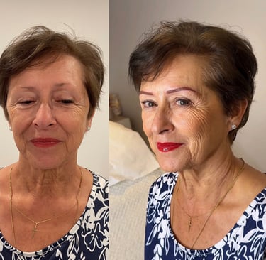 Dermopigmentation de correction chez DermoRepair Clinic Charleville-Mézières