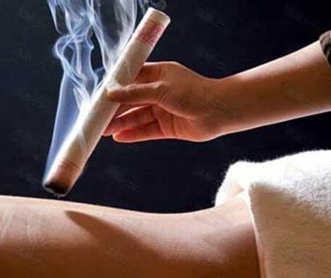 Moxibustion