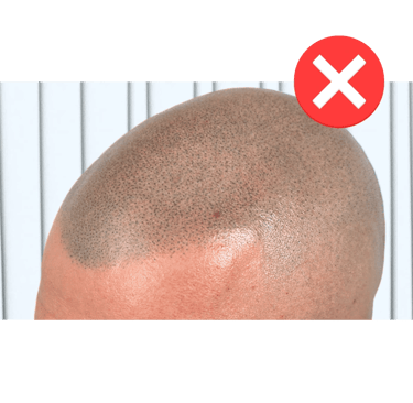 tatuaggio capelli tecnica sbagliata