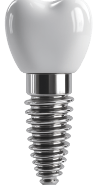 dental implants in mexico