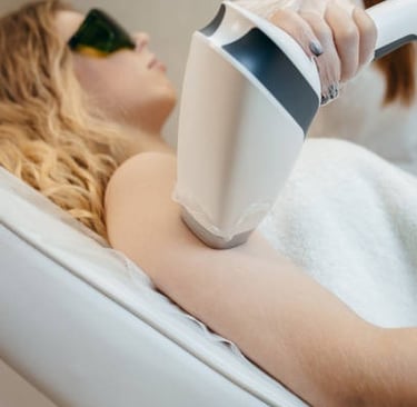 Diyarbakır lazer epilasyon uygulaması