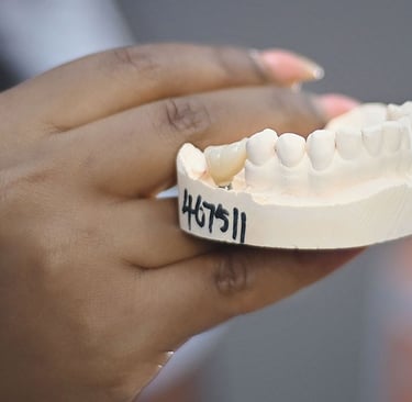 Prothésiste tenant un modèle en plâtre avec une couronne en céramique sur mesure.