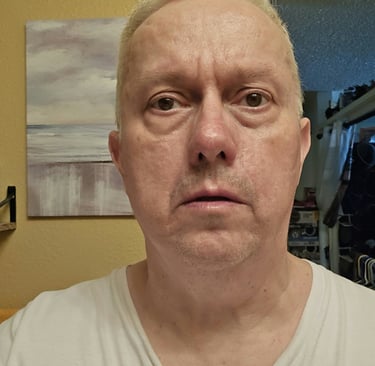 facial psoriasis healed