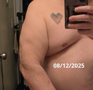 arm psoriasis healed