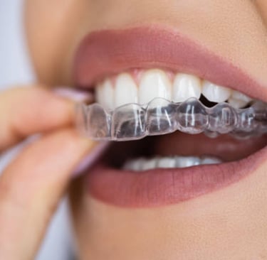  Invisalign Clear Aligners in Naples FL — Benefits, Process & Cost with Dr. Kristina Taranov DDS